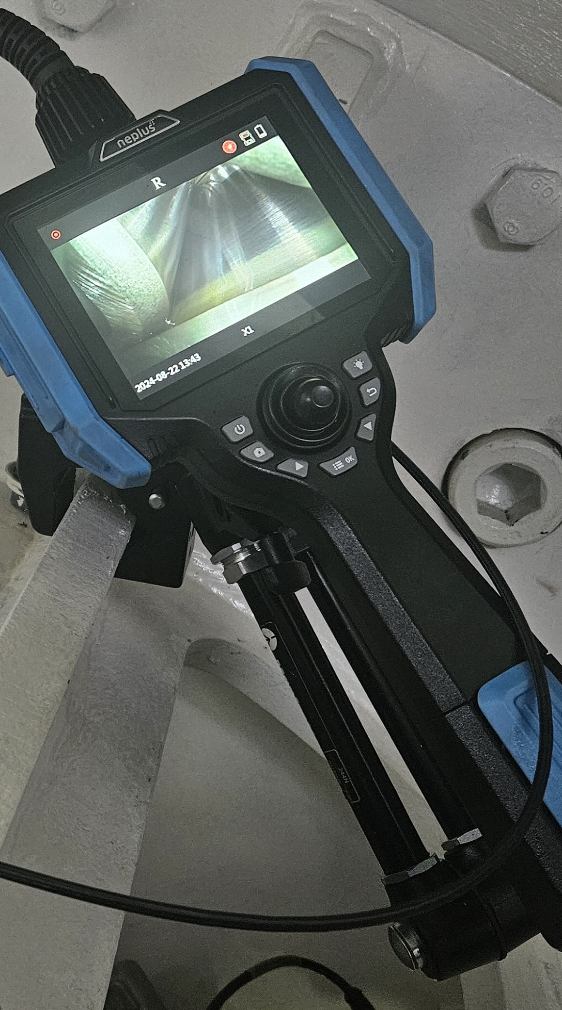 Endoskoopin kuva näytöllä.